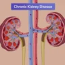 Chronic Kidney Disease