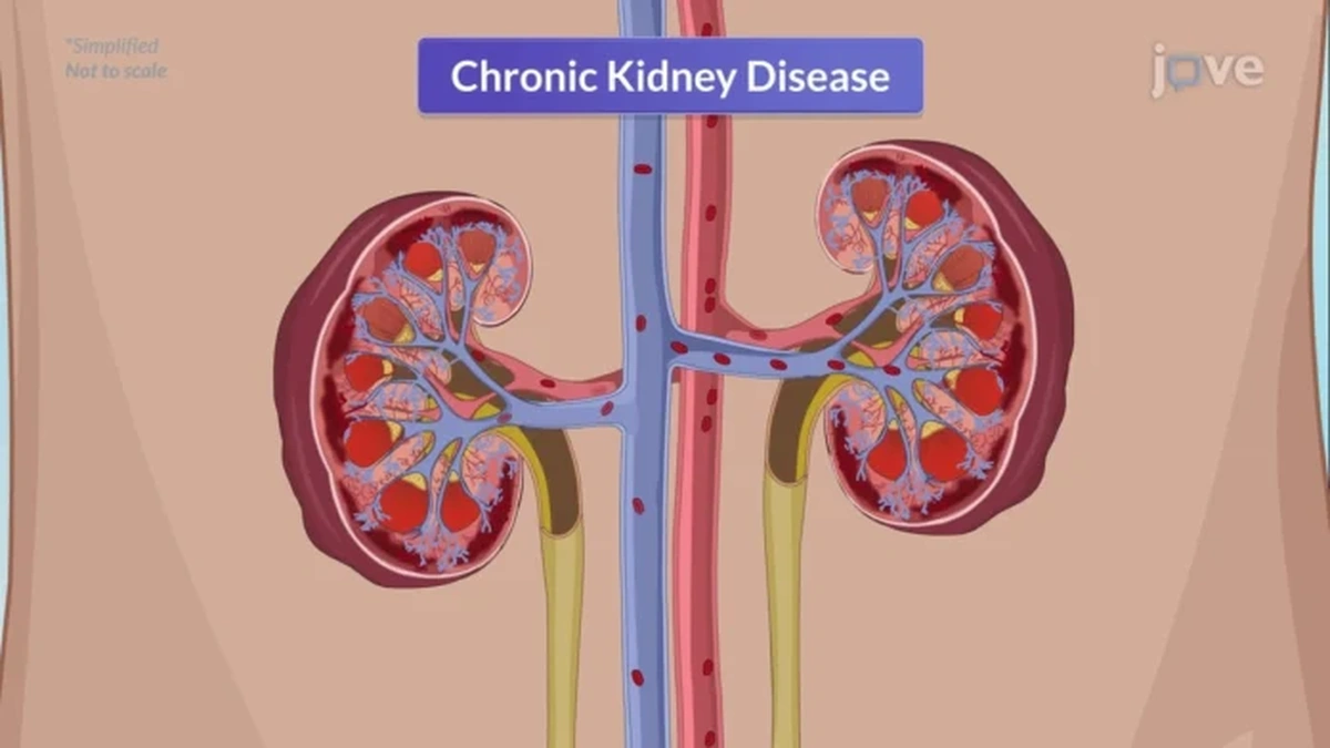 Chronic Kidney Disease